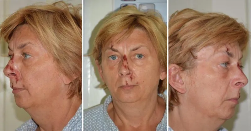 Utvrđen identitet žene pronađene na Krku