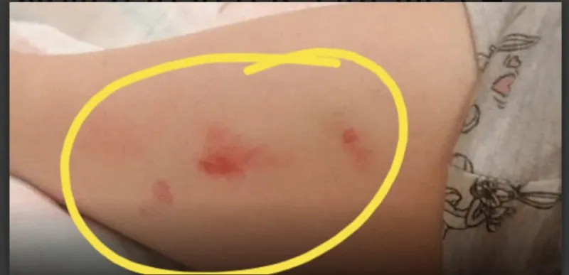 UŽAS: Čopor pasa lutalica napao studenticu u Mostaru