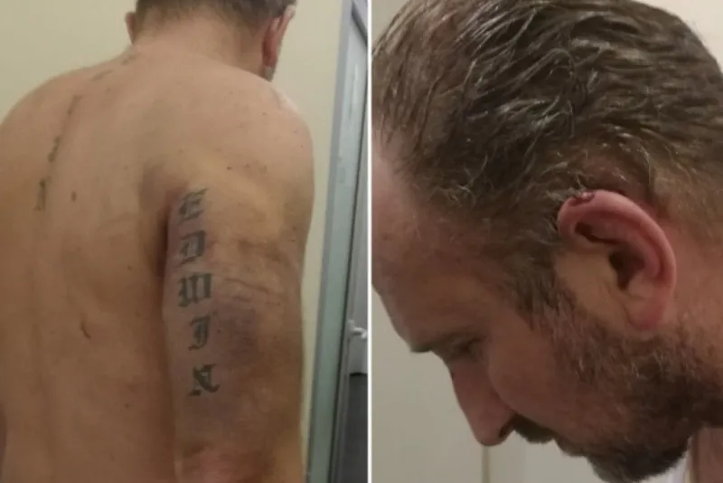 Pljačkaš se žalio da su ga pretukli Posušani i policija