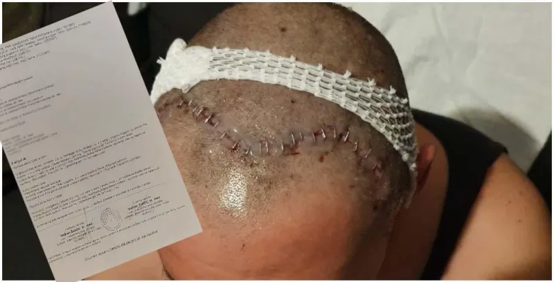 Srbi brutalno pretukli Ivana Andrijanića (28) u Starim Jankovcima, išli su osam na jednoga
