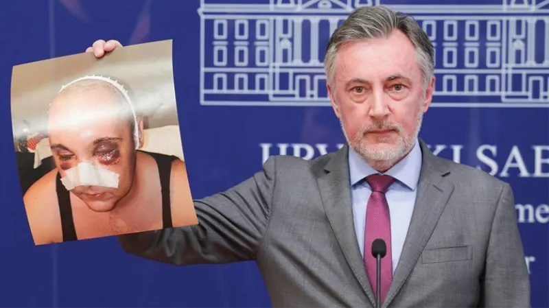 Škoro održao konferenciju zbog premlaćivanja Ivana Andrijanića: Nedopustivo je što rade hrvatski MUP i pravosuđe