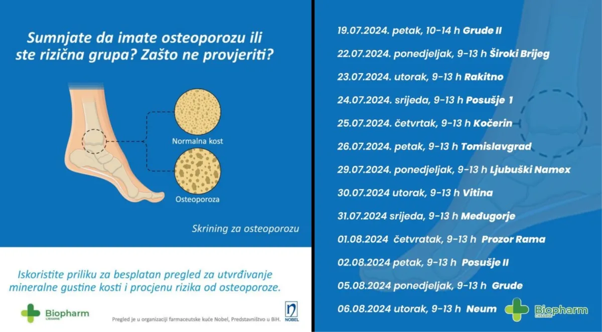 Ljekarna Biopharm: Rezervirajte svoj termin i provjerite mineralnu gustoću kostiju