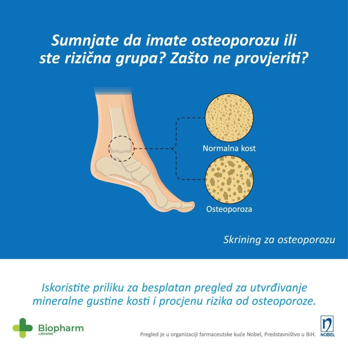 Ljekarna Biopharm: Rezervirajte svoj termin i provjerite mineralnu gustoću kostiju 1